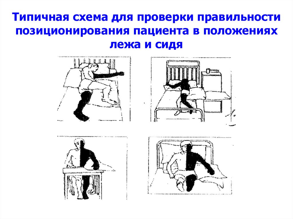 Перемещение пациента сидя на стуле в положение лежа на кровати