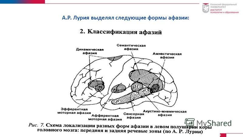 Формы афазии. Классификация афазий а.р.Лурия. Классификация афазии Лурия. Формы афазии Лурия. Классификация афазии Лурия таблица.