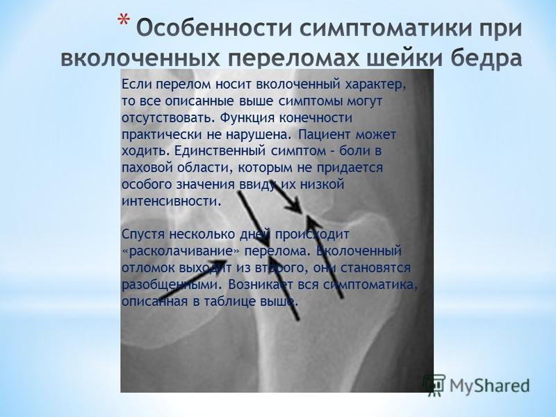 Карта вызова смп перелом шейки бедра справа