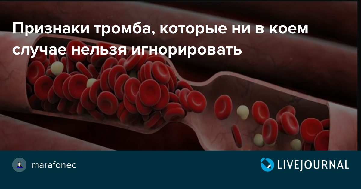 Что значит оторвался тромб у человека