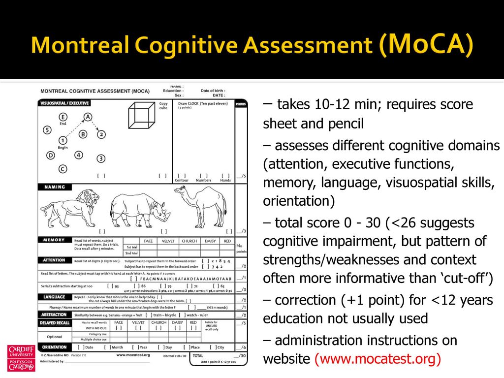 montreal cognitive assessment moca test for dementia