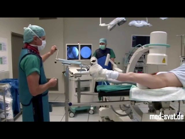 Тазобедренный сустав операция фото. Операция на тазобедренном суставе. Операция на бедренный сустав. Артроскопия тазобедренного сустава операция. Операция на бедро эндопротезирование.