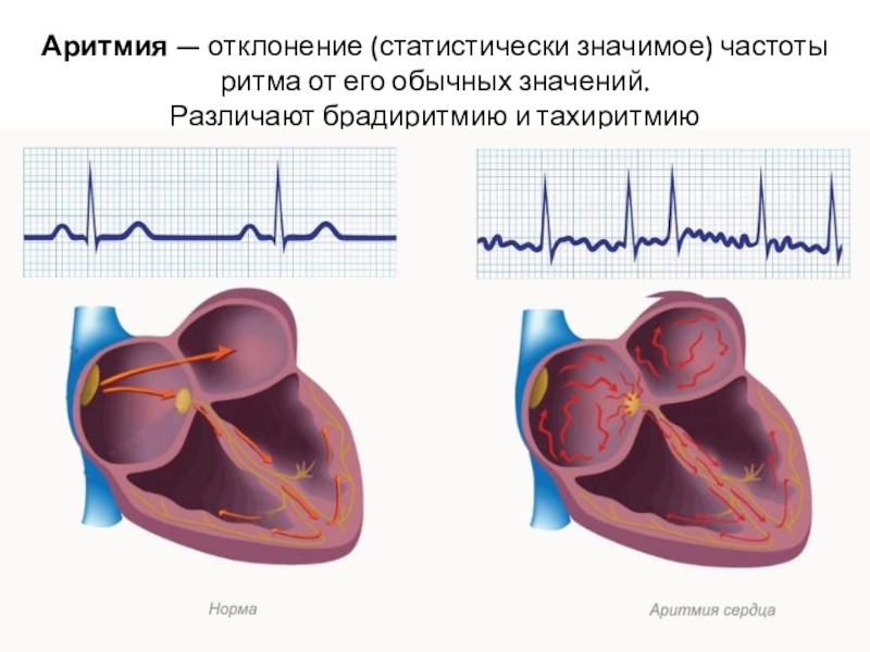 Нарушение работы клапана сердца